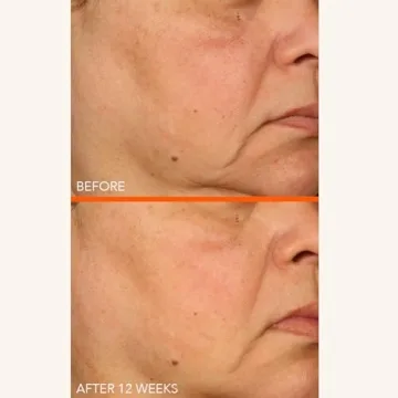 Dr Dennis Gross Vitamin C Lactic 15% Firm & Brighten Serum