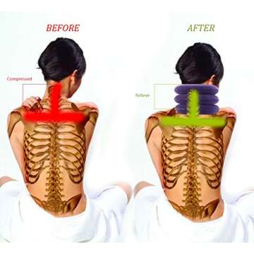 Cervical Neck Traction Device for Neck Pain Relief and Alignment