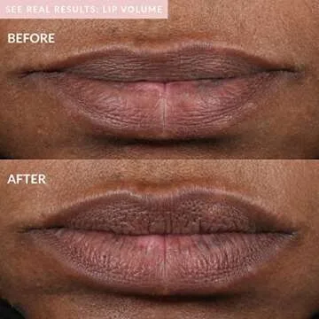 PMD Kiss Lip Plumping System for Youthful Lips