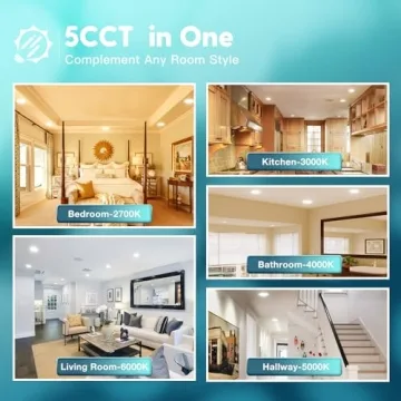 FREELICHT Dimmable LED Can Lights - Energy Efficient & Customizable