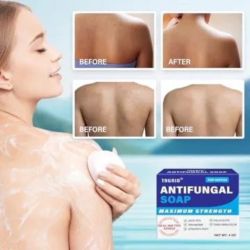TAGRID Antifungal Soap for Jock Itch and Athlete's Foot