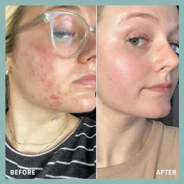 BOHO Skin Cleansing Balm - Hydrating & Moisturizing Facial Cleanser & Makeup Remover Balm for All Skin Types - Natural Deep Pore Cleanser with Vitamin E & Botanical Extracts (2oz)