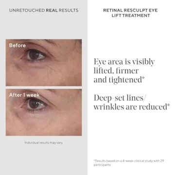 Murad Retinal Eye Lift Cream - Anti-Aging Treatment for Eyes