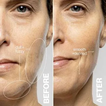 DERMAFLASH LUXE+ - Exfoliation & Hair Removal Device