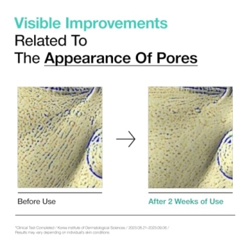 ANUA 2% BHA Gentle Exfoliating Toner for Radiant Skin