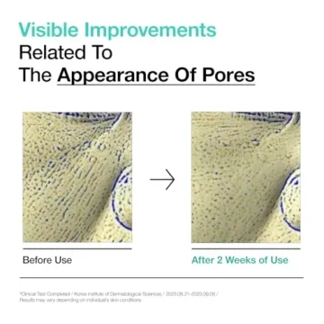 ANUA 2% BHA Gentle Exfoliating Toner for Radiant Skin