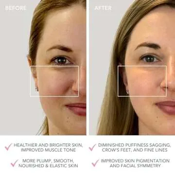 FOREO BEAR Mini Microcurrent Facial Device - Face Sculpting Tool - Firm & Contour - Reduce Double Chin - Non-Invasive - Increases Absorption of Facial Skin Care Products - Pearl Pink