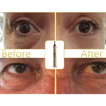 GLO24K Instant Facelift Cream with 24k Gold and Hyaluronic Acid