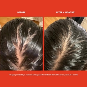 HoliRoots Serum - Nourishing Hair Growth Oil for All Types