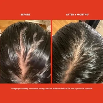 HoliRoots Serum - Nourishing Hair Growth Oil for All Types