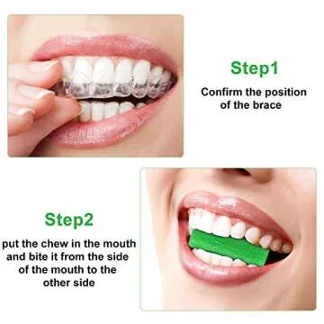 10 Pieces Aligner for Aligner Chompers Aligner Trays Seater Orthodontic Dental aligner(Green)