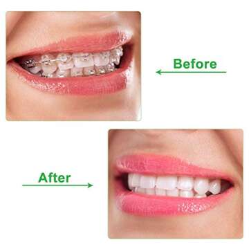 10 Pieces Aligner for Aligner Chompers Aligner Trays Seater Orthodontic Dental aligner(Green)