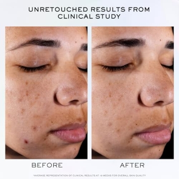 Lancôme Clarifique Face Serum for Brightening Skin