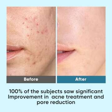 Elvira Korean Skincare Anti-Aging & Glycolic Acid Exfoliating Facial Pads With 10% Glycolic Acid, 2%...