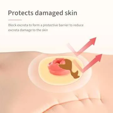 DERAYMI 10 Pack Moldable Ostomy Barrier Rings, 4mm Thickness Barrier Rings for Ostomy Bags, Sting-Free Hydrocolloid Ileostomy Elastic Ostomy Rings Secure Seal for Colostomy Bags