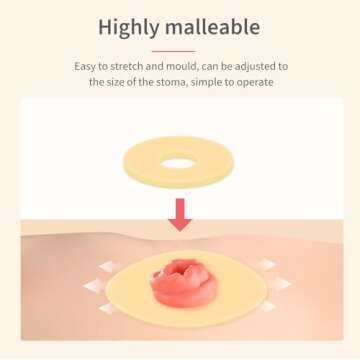 DERAYMI 10 Pack Moldable Ostomy Barrier Rings, 4mm Thickness Barrier Rings for Ostomy Bags, Sting-Free Hydrocolloid Ileostomy Elastic Ostomy Rings Secure Seal for Colostomy Bags