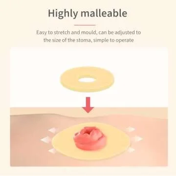 DERAYMI 10 Pack Moldable Ostomy Barrier Rings, 4mm Thickness Barrier Rings for Ostomy Bags, Sting-Free Hydrocolloid Ileostomy Elastic Ostomy Rings Secure Seal for Colostomy Bags