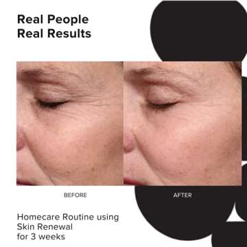 PRIORI Skincare Skin Renewal Cream with Lactic Acid Retexturizing Face Moisturizer for Dark Spots, Fine Lines & Wrinkles, Acne Scars Vitamin C, E, Fragrance Free Women & Men Skincare 1.7 fl oz