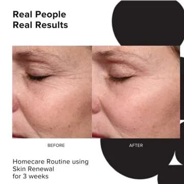 PRIORI Skincare Skin Renewal Cream with Lactic Acid Retexturizing Face Moisturizer for Dark Spots, Fine Lines & Wrinkles, Acne Scars Vitamin C, E, Fragrance Free Women & Men Skincare 1.7 fl oz