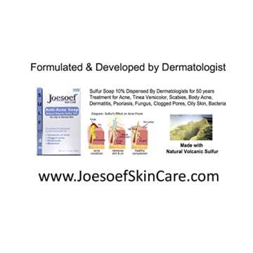 JOESOEF Sulfur Soap for Acne Treatment Dermatologist Approved