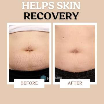 Maternity Stretch Mark Cream & Serum for Sensitive Skin