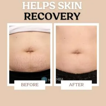 Maternity Stretch Mark Cream & Serum for Sensitive Skin