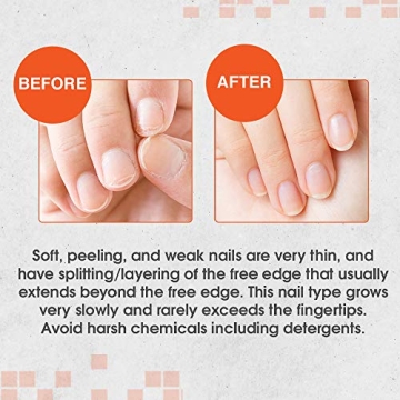 Nail Tek Intensive Therapy 2 - Strengthen Weak Nails effectively