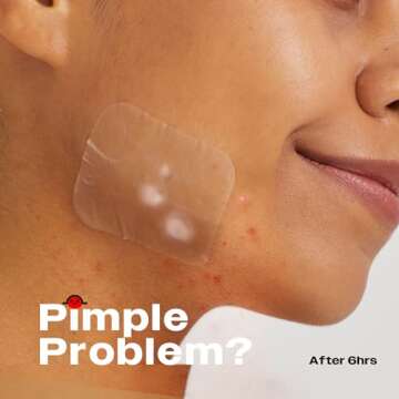 AVARELLE Acne Patches XL, FSA HSA Acne Patch Large | Pimple Patches for Face Cheek & Nose (8 Count) ...