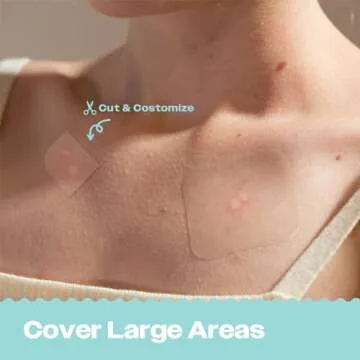 AVARELLE Acne Patches XL, FSA HSA Acne Patch Large | Pimple Patches for Face Cheek & Nose (8 Count) | Large Hydrocolloid Acne Treatment with Tea Tree, Calendula, & Cica by ZITOUT™