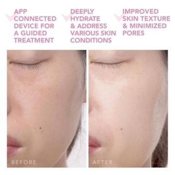 Optimize Your Skin with the FOREO UFO 2 Face Mask Device