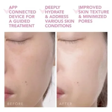 Optimize Your Skin with the FOREO UFO 2 Face Mask Device