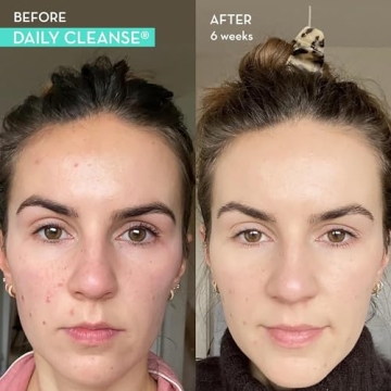 HUM Daily Cleanse - Clear Skin Detox Supplement with Herbs