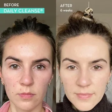 HUM Daily Cleanse - Clear Skin Detox Supplement with Herbs