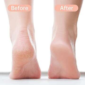 Foot File Callus Remover for Feet, Feet Filer for Dead Skin, (1pc) Pink, Double Side Metal Foot File Stainless Steel, Pedicure Foot Rasp, Foot Scraper to Remove Hard Skin, Birthday, Holiday Gift