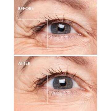 depology Deepcare+ Serum-Infused Micro Dart Patche | 4 Pairs Eye Mask | Under Eye Patches for Wrinkles | Fine Lines | Hydrating Eye Mask with Peptides | Amino Acids | and Synthesized Molecules