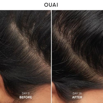 OUAI Anti Dandruff Shampoo - Soothe Flaky Scalp