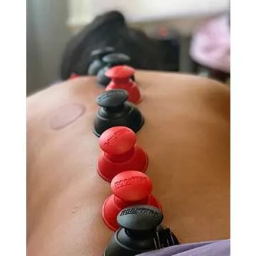 RockTape 2-Piece Cupping Set for At-Home Therapy