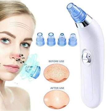 Effective Blackhead Remover Pore Vacuum for Clear Skin