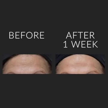 Kate Somerville ExfoliKate Glow Moisturizer Daily Cream 1.7 Fl Oz