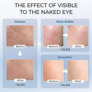 Blue Red Light Therapy Mask for Face, 7 Colors LED Face Mask Light Therapy, Led Face Mask Light Therapy At Home, Black