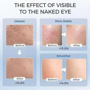 7 Color LED Face Mask Light Therapy for All Skin Types