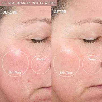 PMD Beauty Elite Pro Microdermabrasion Machine