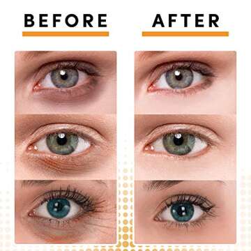 MELIA Under Eye Patches Eye Mask for Puffy Eyes, Dark Circles and Under Eye Bags Treatment With Hyaluronic Acid and Snail Slime Extract