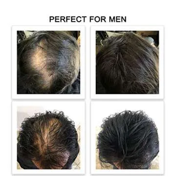 FEBRON Hair Fibers - Natural Hair Loss Concealer for All