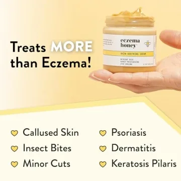 ECZEMA HONEY Skin-Soothing Cream for All Ages - 4 Oz