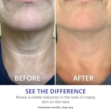 goPure Neck Firming Cream for Anti-Aging and Hydration
