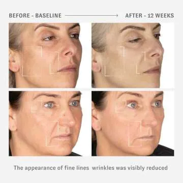 O HUI Reverse Activator Retinol Fine Wrinkle Cream | Korean Skin Care | Comfortable Retinol Cream for Face | Minimal to no irritation | Peptide | Wrinkles Visibly Reduced by 42% in 8 Weeks