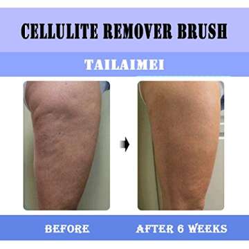 TailaiMei Anti Cellulite Massager - Boost Circulation & Skin Smoothness