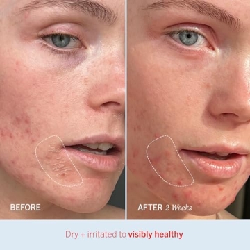 First Aid Beauty Ultra Repair Cream for All Skin Types