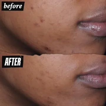 Kiehl's Better Screen UV Serum SPF 50+ for Radiant Skin